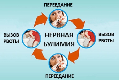 Лечение булимии в Вихоревке